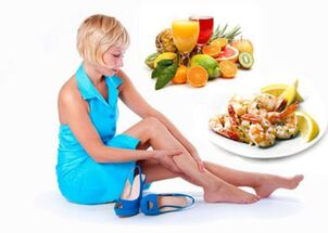 Proper nutrition in the treatment of varicose veins