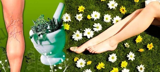 Folk remedies for the treatment of varicose veins of the legs, contributing to rapid recovery